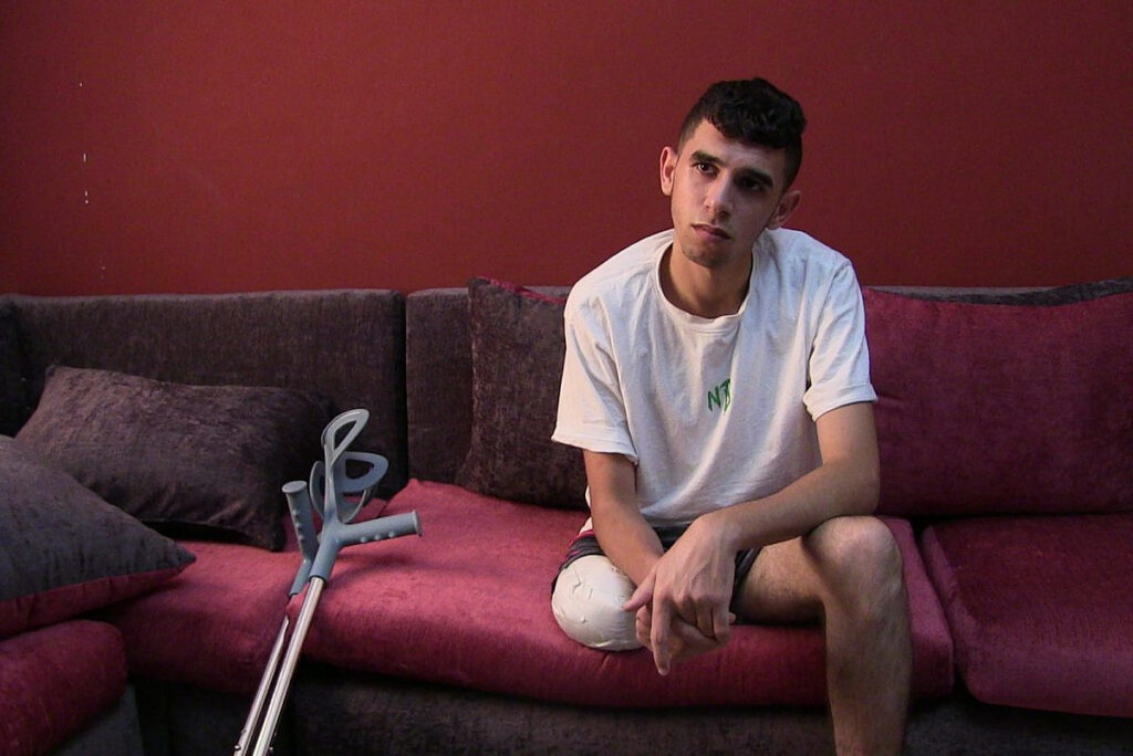 Σε έναν καφετί καναπέ μπροστά από έναν κόκκινο τοίχο, ένα νεαρό αγόρι με καστανά κοντά μαλλιά και καλοκαιρινά ρούχα κοιτά απέναντί του σα να ακούει κάποιον να του μιλά. Το ένα του πόδι, κομμένο ως το γόνατο, είναι τυλιγμένο με επιδέσμους, ενώ δίπλα του στο μαξιλάρι τού καναπέ στηρίζονται οι δυο του γκρι πατερίτσες.